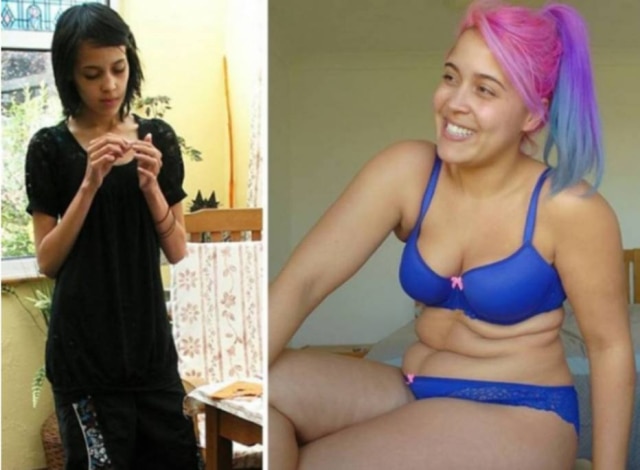 Instagram/@bodyposipanda Atualmente, Megan Crabble trabalha é digital influencer e ajuda mulheres na aceitação do corpo