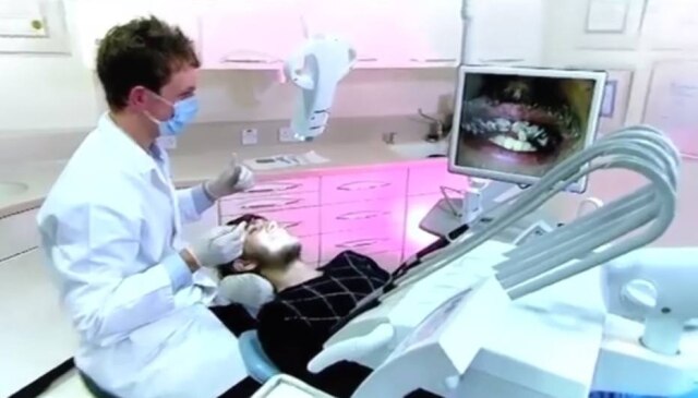 YouTube / @Only Human O jovem Jay ficou cerca de duas décadas sem escovar seus dentes da forma correta