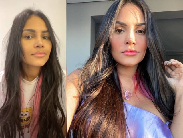 Instagram / @flay Flayslane mostrou o resultado da rinoplastia que realizou recentemente