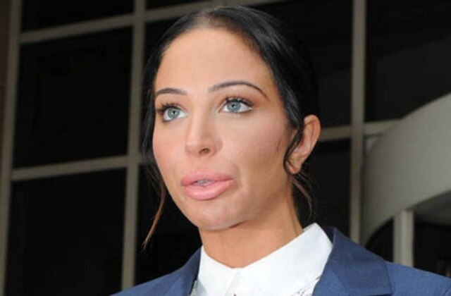 Reprodução Tulisa Contostavlos após preenchimento labial.