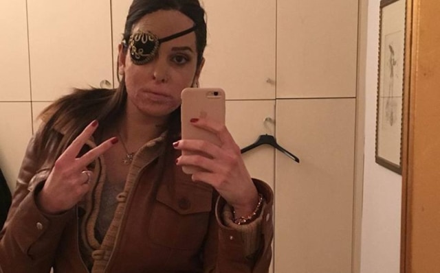 Instagram.com/gessica.notaro Gessica foi atacada pelo ex-namorado em janeiro de 2017