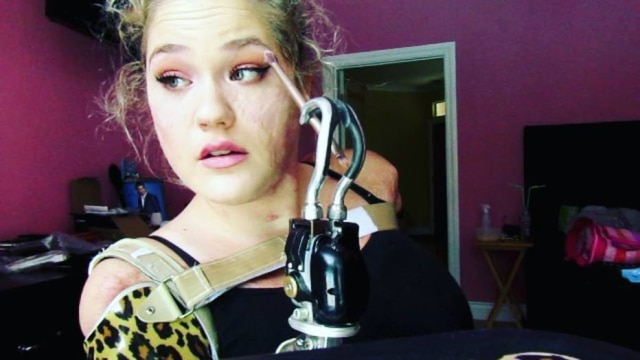Reprodução/Instagram A youtuber Kaitlyn Dobrow perdeu os membros em decorrência de uma meningite