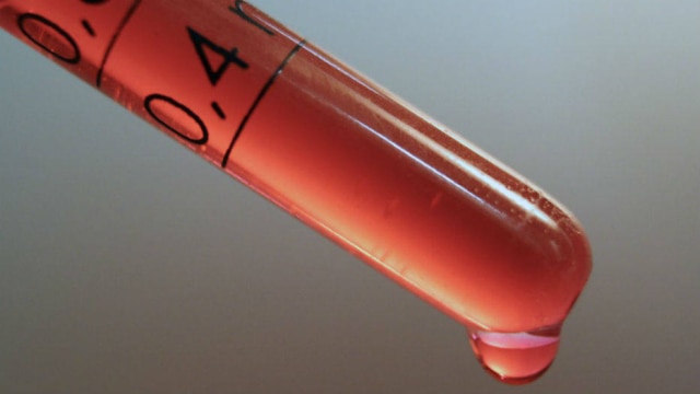Khaled Alta/Creative Commons Pesquisadores britânicos identificaram 16 proteínas no sangue que estão relacionadas ao aparecimento de Alzheimer