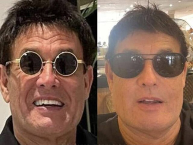 Instagram/@serginhomallandro O humorista Sergio Mallandro, que fez harmonização facial