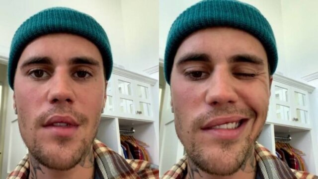 Instagram/@justinbieber O cantor Justin Bieber foi diagnosticado com a síndrome de Ramsay Hunt, que paralisou metade de seu rosto.