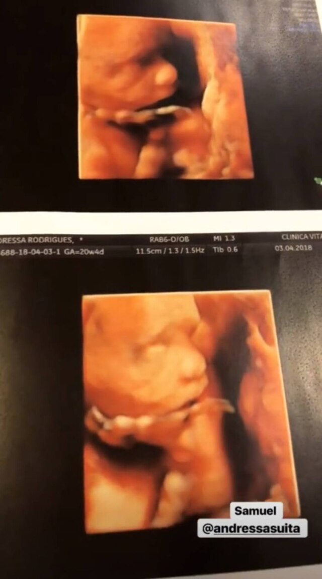 Instagram / @gusttavolima Ultrassom de Samuel, segundo filho do cantor Gusttavo Lima.