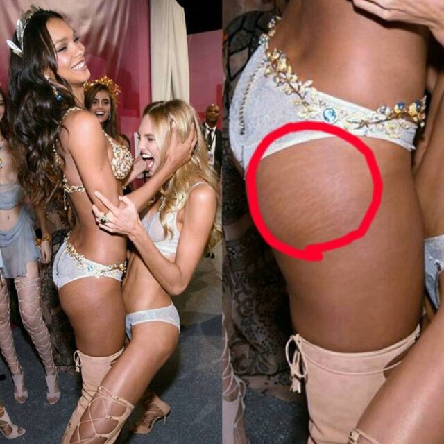 Instagram/ @victoriassecret_passion Conta no Instagram percebeu estrias de Lais Ribeiro durante o desfile da Victoria's Secret