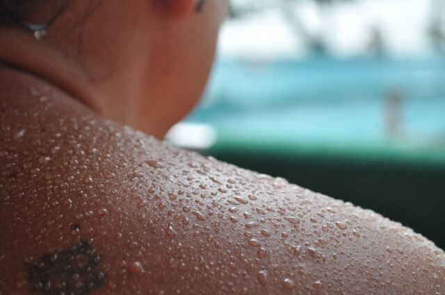 Toxina botulínica pode ser injetada em diversas partes do corpo para impedir a sudorese e ajuda no período de verão