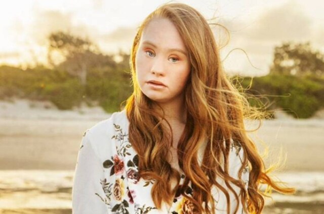 Instagram/@madelinesmodelling A australiana estreou em 2015 nas passarelas internacionais