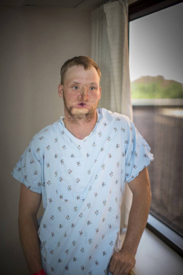 Eric M. Sheahan/Mayo Clinic via AP Sandness à espera do transplante, em junho de 2016