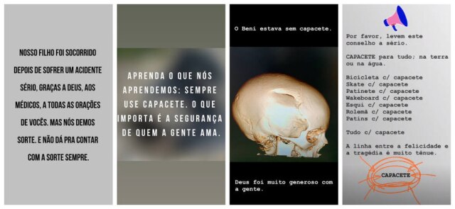 Instagram/@lucianohuck Luciano Huck mostrou exame de imagem de Benício e fez um alerta para os seguidores.