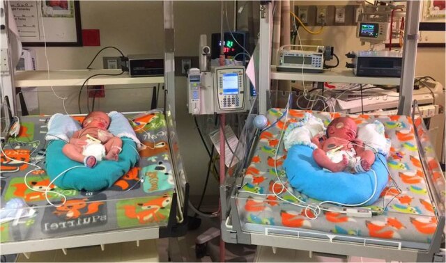 Reprodução/Facebook James e Mathew nasceram com dois minutos de diferença, mas em anos diferentes