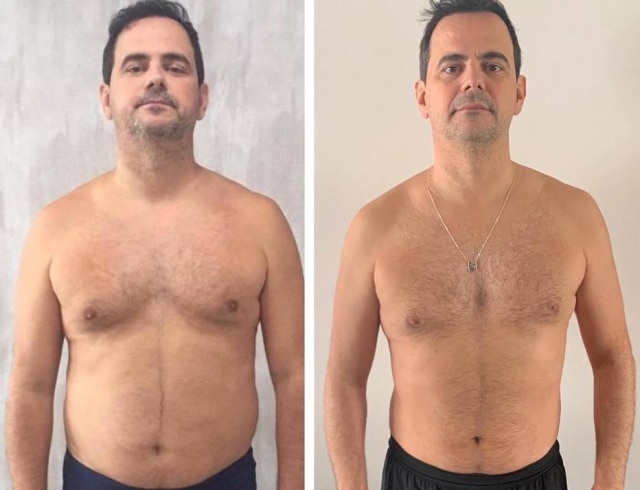 Instagram / @carioca 'Antes e depois' publicado por Carioca.
