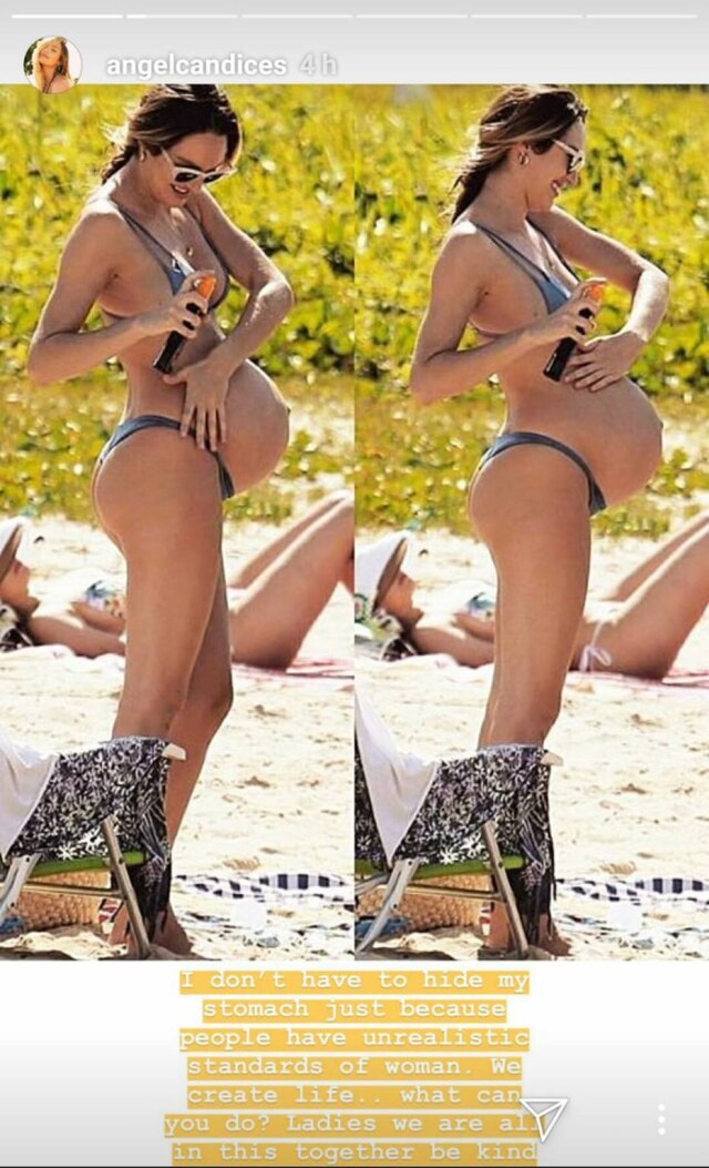 Instagram/@angelcandices A modelo sul-africana Candice Swanepoel respondeu às críticas por usar bíquini duas semanas após dar à luz seu segundo filho