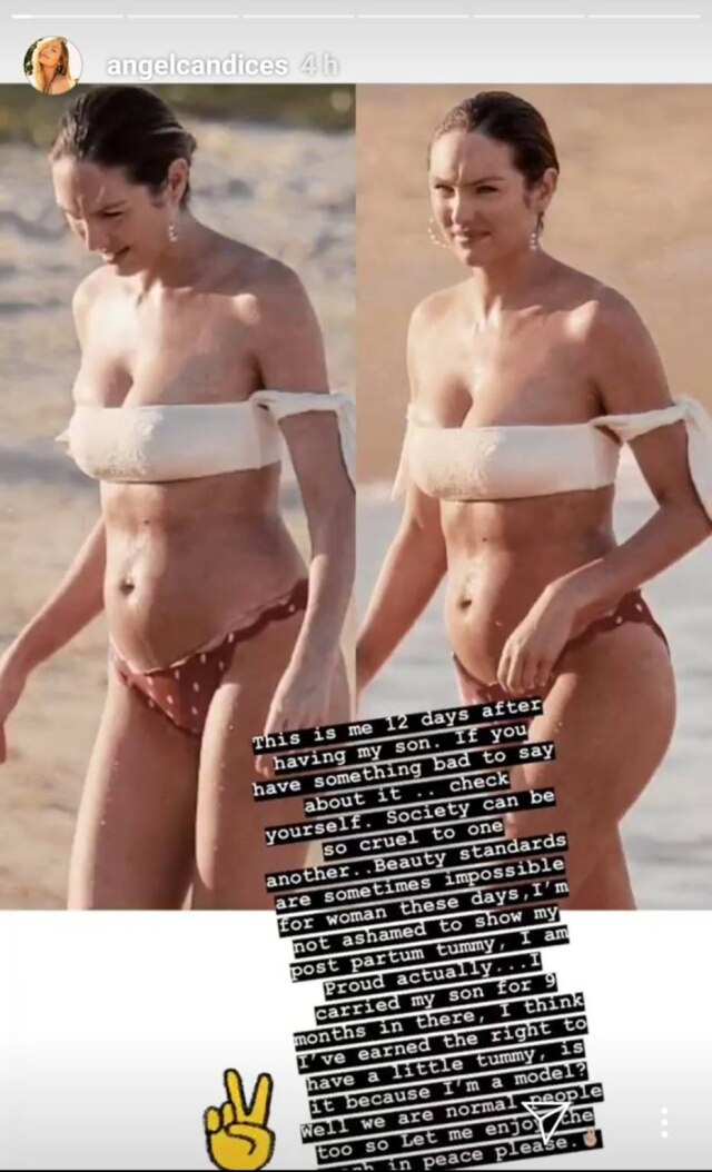 Instagram/@angelcandices A modelo sul-africana Candice Swanepoel respondeu às críticas por usar bíquini duas semanas após dar à luz seu segundo filho