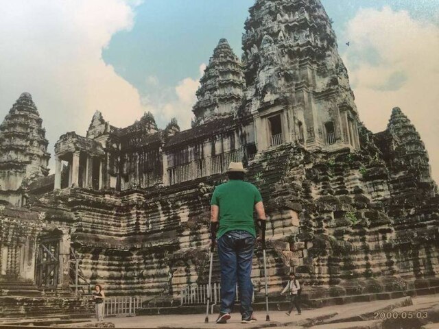 Arquivo pessoal Luiz Thadeu em Camboja. Após o acidente, o nordestino ficou com uma perna maior que a outra e não pode andar mais de 100 metros sem muletas para não sobrecarregar essa parte do corpo.