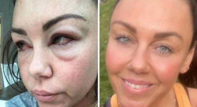 Instagram/@wonderwomanshel A cantora inglesa Michelle Heaton, que se abriu sobre problemas com alcoolismo