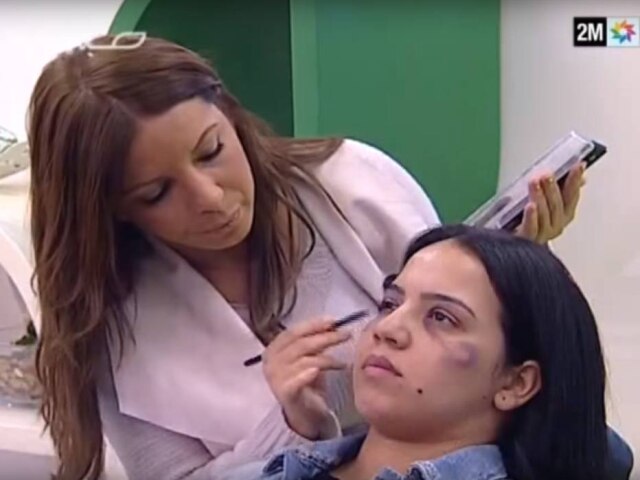 Reprodução Tutorial de maquiagem ensinou como cobrir hematomas causados por violência doméstica