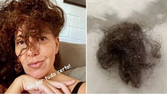 Instagram/ @fabiulaa Fabiula Nascimento mostra queda de cabelo nas redes sociais