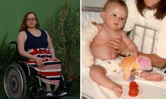 Caio Nascimento / Estadão | Elaine Paiva / Arquivo Pessoal Elaine Paiva foi atropelada em 1987 antes de completar um ano de idade. Na foto da direita, ela está enfaixada na cama do hospital, em São Paulo, aos 11 meses de vida.