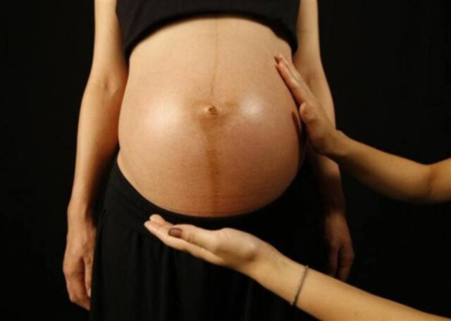Kim Kyung-Hoon/ Reuters 'A microcefalia é condição patológica em que existem volume e peso encefálico muito menor do que o normal', explica o neutropediatra