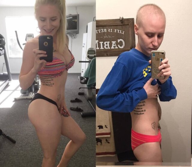 Reprodução/Instagram Youtuber fitness americana foi diagnosticada com câncer de ovário.