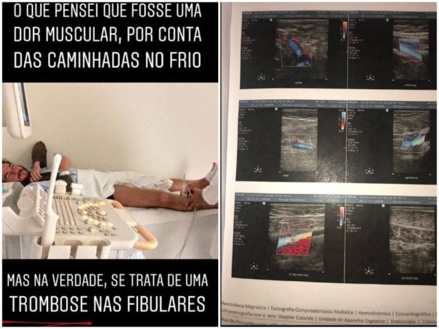 tulio.gadelha/ Instagram Túlio Gadêlha é diagnosticado com trombose