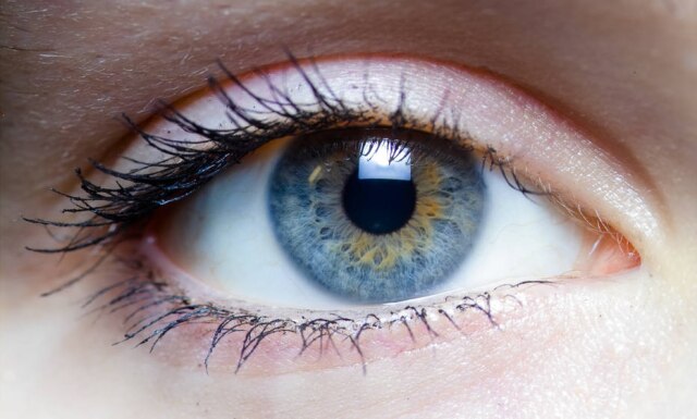 Laitr Keiows / Creative Commons Os principais sintomas de blefarite são coceira nos olhos, irritação, lacrimejamento, sensação de areia ou queimação, cílios grudados uns aos outros ou até perda dos cílios