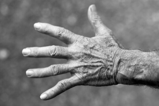 Pixabay As causas do Mal de Parkinson ainda não são estudadas