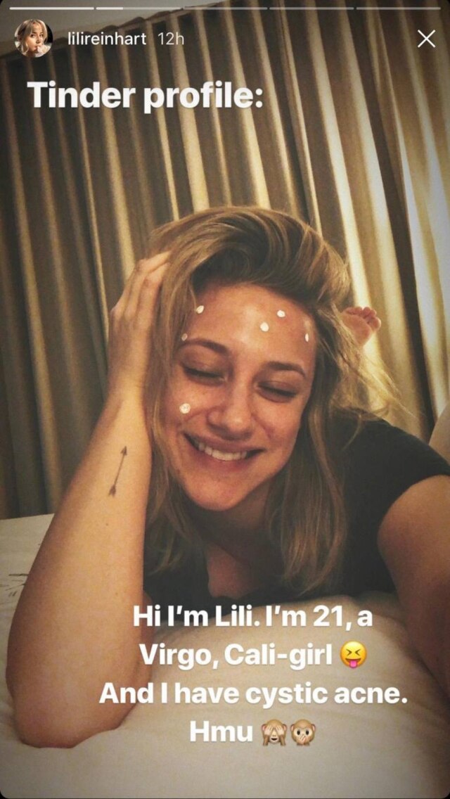Instagram/@lilireinhart "Perfil do Tinder: Oi, eu sou a Lili. Tenho 21 anos, sou virginiana, garota da Califórnia e tenho acne cística", brincou a atriz Lili Reinhart em seu Instagram