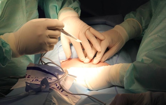 Pixabay/ deborabalves A cirurgia bariátrica é o tratamento para a obesidade que reúne um conjunto de técnicas de diminuição do estômago