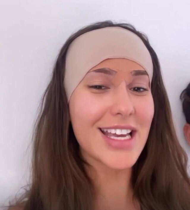 Instagram / @ThaisBraz Procedimento escolhido por Thais se chama frontoplastia e custou 25 mil reais.