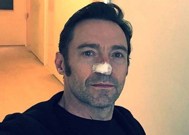 Reprodução/Instagram Hugh Jackman recebeu o primeiro diagnóstico de câncer de pele em 2013.