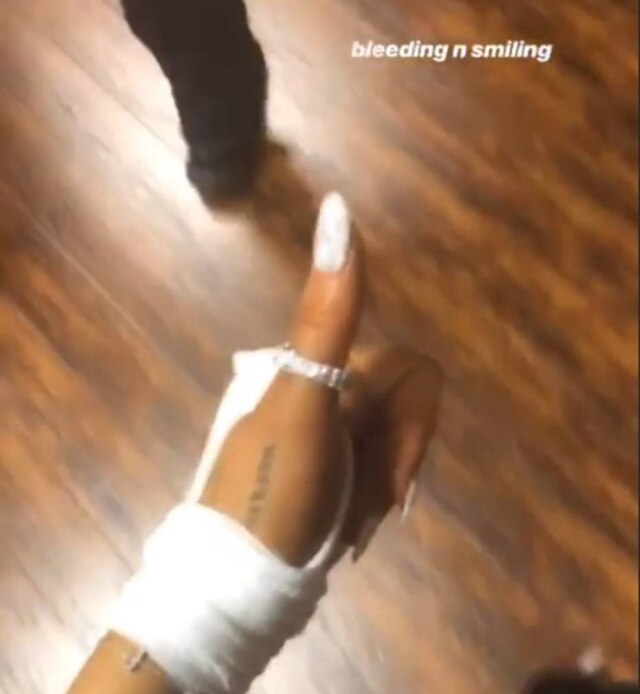 Instagram / @arianagrande Ariana Grande caminhava exibindo a mão com a atadura e o seu anel luxuoso de noivado.