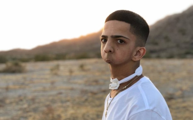 Instagram / @xvx_6 Isaiah Acosta nasceu sem a mandíbula e faz sucesso no mundo da música com suas letras e determinação.