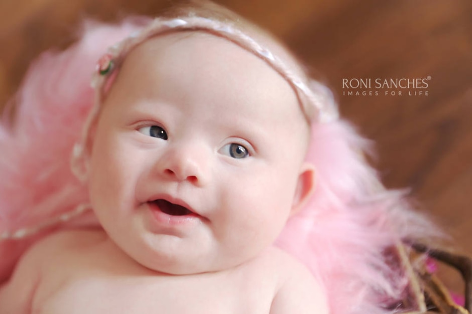 Fotógrafo faz ensaio de recém-nascidos com Síndrome de Down - Emais